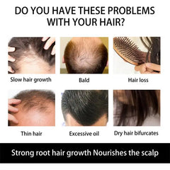 Natural Hair Beard Growth Derma Micro Dermaroller Hair Regrowth Anti Hair Loss Men Hair Growth Products